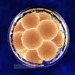 体外受精 | 冷冻胚胎移植应该选择人工周期还是自然周期？