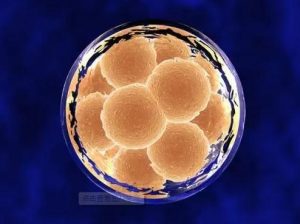 体外受精 | 冷冻胚胎移植应该选择人工周期还是自然周期？