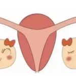 冷冻胚泡和新鲜胚泡哪个检测着床更快? 难怪很容易怀上双胞胎! 冷冻胚泡和新鲜胚泡哪个检测着床更快? 难怪很容易怀上双胞胎!