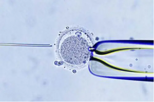 两姐妹同时怀孕，同一天生产。 孩子们看起来出奇地相似。 亲子鉴定后，他们傻眼了