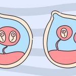 在 IVF 治疗周期中可能会出现哪些问题? 在 IVF 治疗周期中可能会出现哪些问题?