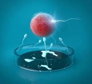 丈夫染色体罗氏易位致妻子多年不孕