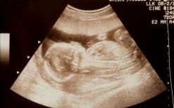 「备孕常见问题」备孕常见问题大盘点