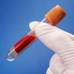 三代试管机构-生男生女问题