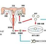 (东莞试管医院推荐)东莞试管成功率最高的医院[广东试管婴儿]