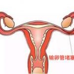 昆明基因突变可以做试管婴儿吗_正规三代试管机构 昆明基因突变可以做试管婴儿吗_正规三代试管机构