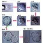冷冻卵子也存在缺陷,冷冻卵子条件 冷冻卵子也存在缺陷,冷冻卵子条件