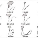 如何解决宝宝取名时碰到的问题 如何解决宝宝取名时碰到的问题