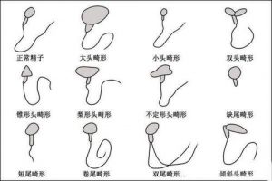 如何解决宝宝取名时碰到的问题