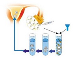 B超检查有利有害要控量