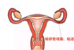 北京协和医院三代试管成功率高不高[北京试管婴儿]