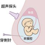 邯郸三代试管可以选男女吗？邯郸三代试管可以选男女吗多少钱？