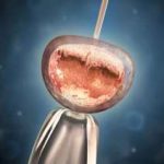 泪腺按摩注意事项(新生儿泪腺按摩方法) 泪腺按摩注意事项(新生儿泪腺按摩方法)