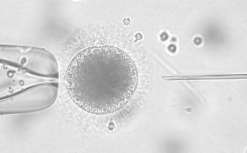 (秦皇岛妇幼试管成功率)秦皇岛妇幼试管成功率高吗[河北试管婴儿]