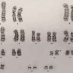排卵期检查性激素六项准确吗(排卵期是什么时候) 排卵期检查性激素六项准确吗(排卵期是什么时候)