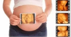 高龄孕妇产假多长时间 高龄产妇生二胎产假多少天