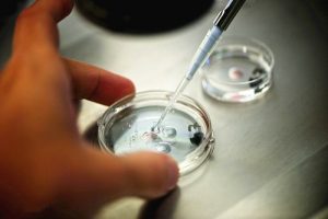 精子能放冰箱进行冷冻储藏吗