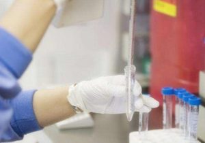 婴儿肚脐带怎么护理