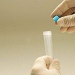 男人怎么调理精子生女孩几率大[生男生女]