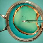 济南捐卵试管价格-山东济南正规生殖机构三代试管费用多少？