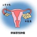 国内试管助孕捐卵公司——又一专家呼吁“捐卵自由”! 中国捐卵有多难? 国内试管助孕捐卵公司——又一专家呼吁“捐卵自由”! 中国捐卵有多难?