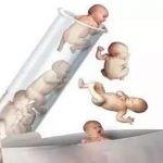 专家建议，取卵后这样调理卵巢是对的！