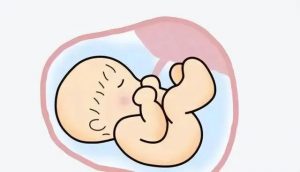 高龄女性可以做三代试管婴儿吗？ 需要注意哪些问题？