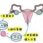卵巢早衰难怀孕,中医针灸助“好孕”! 卵巢早衰难怀孕,中医针灸助“好孕”!