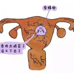 针灸可以帮助你怀孕吗? 这是真的吗?中医专家为您解答 针灸可以帮助你怀孕吗? 这是真的吗?中医专家为您解答