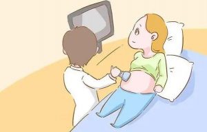 IVF医院的成功率高吗？ 问题与解答