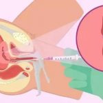 中医调经助孕两年,试管助孕却成功受孕 中医调经助孕两年,试管助孕却成功受孕