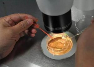 远东龙岗妇产医院启动深圳市助孕公益项目，实现深圳人受孕梦想