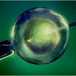 科普｜第三代试管婴儿是高龄女性生育的最佳选择！