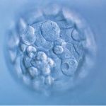 试管取卵会导致卵巢早衰吗？ 试管过程中有哪些传闻？