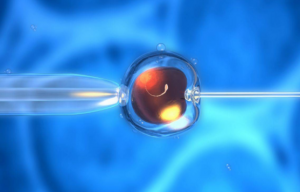 先天性X染色体缺失可以做供卵试管试管婴儿吗？