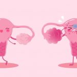 三代试管只有一个成功，是否需要送检？