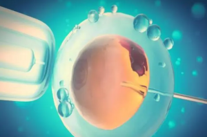 【干货】染色体异常检测，揭开反复流产成因之谜