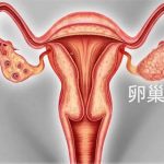 厦门网友：哭死！ 老婆说我三宫外孕有问题，怪我不准！ 没想到很多人以为…