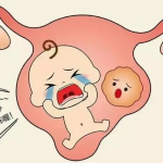 北京东方医院生殖科供卵三代试管要多少钱？