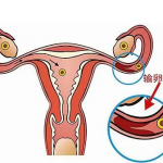 新鲜胚胎、冷冻胚胎、囊胚，哪种胚胎移植成功率最高？