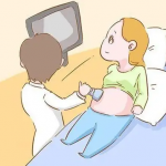 为什么大部分捐供卵三代试管受孕都是双胞胎，而且成功的概率其实不是很高？