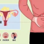 倪海霞：中医助孕唯一的缺点就是生的都是男孩，那西医呢？