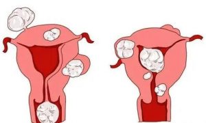 天津市中心妇产医院供卵试管费用是多少？ 申请捐卵有什么条件？