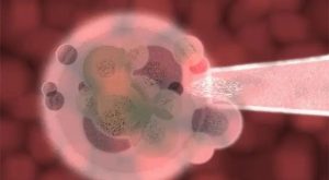 如果女性染色体有问题，是否需要捐卵？