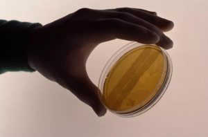 一支试管的成功率是多少？ 试管成功率高吗？