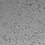 2023年杭州供卵试管费用参考（附医院排名）