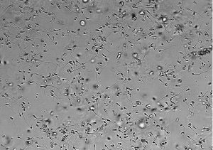 2023年杭州供卵试管费用参考（附医院排名）