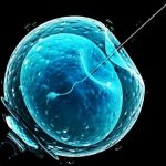 切除一半子宫后还能怀孕吗? 染色体异常一定会流产吗? 第三代试管婴儿染色体易位 切除一半子宫后还能怀孕吗? 染色体异常一定会流产吗? 第三代试管婴儿染色体易位