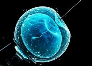 切除一半子宫后还能怀孕吗？ 染色体异常一定会流产吗？ 第三代试管婴儿染色体易位