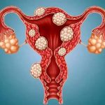 2023年武汉协和医院做三代试管，可以选择生男孩